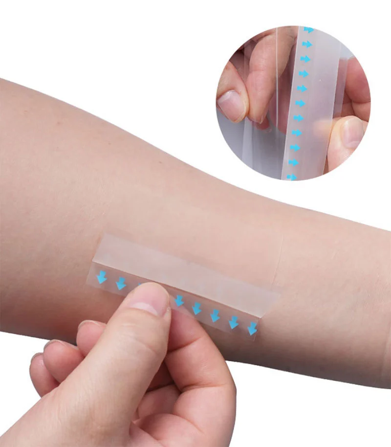 Bordered Hydrocolloid Dressing Roll With Pull Tab For Venous Ulcers